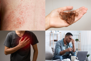lupus symptoms examples