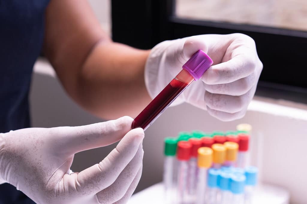 Medical provider preparing a blood sample for A1C testing at Agape Family Health