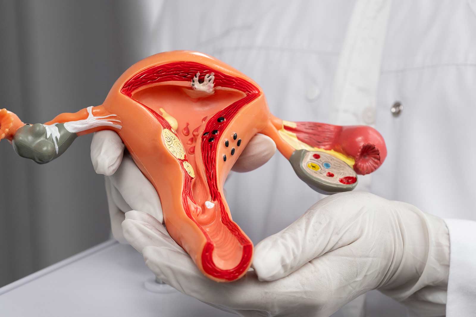 Doctor holding anatomic model